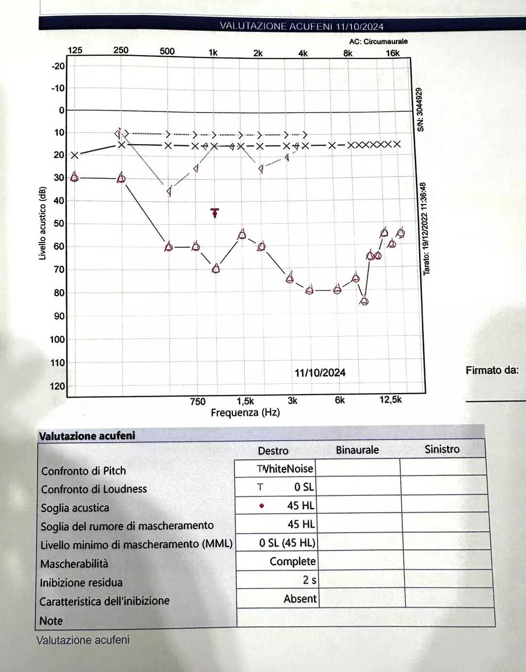 Ipoacusia Neurosensoriale Improvvisa